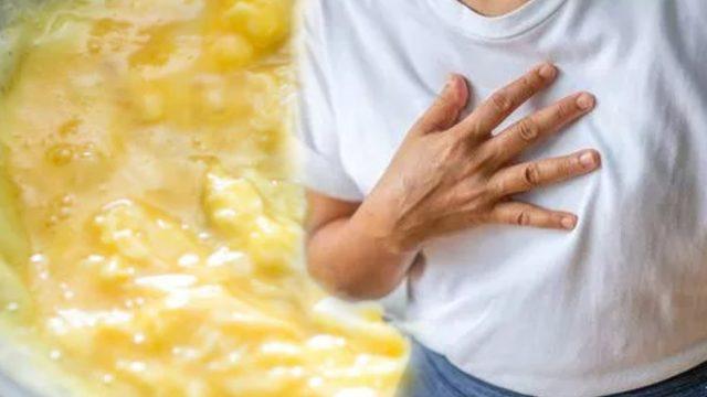 Her gün yediğimiz bu gıda damarları tıkıyor! Felç riskini artıyor