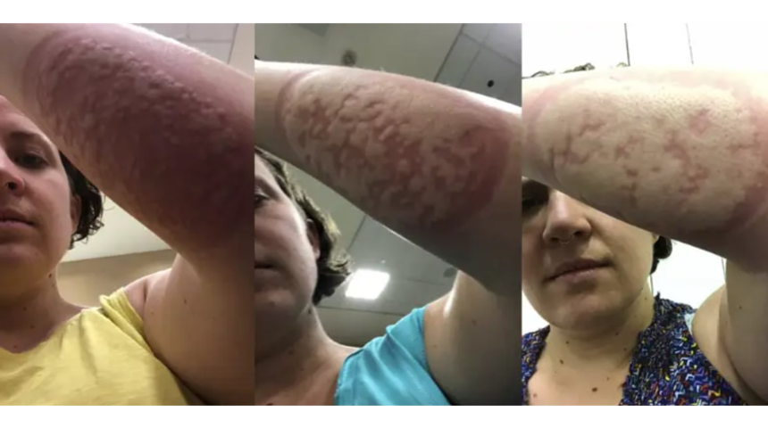 Önce gönüllü sonra pişman oldu: Aşı testinde başına gelmeyen kalmadı