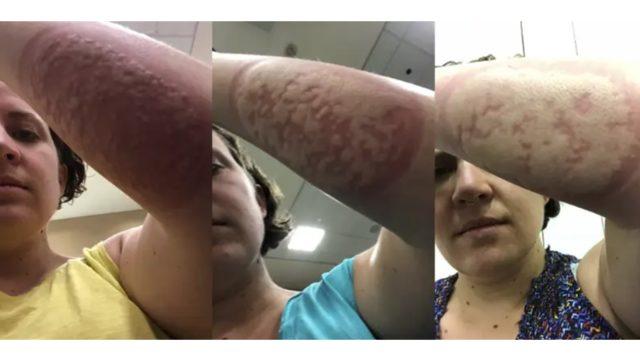 Önce gönüllü sonra pişman oldu: Aşı testinde başına gelmeyen kalmadı