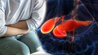 Pankreas kanseri 3 yıl önce tespit edilebilir! Hayati önemi var