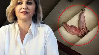 Profesörün muayenehanesine dana dili göndermişti! 10 yıl hapis istemiyle dava açıldı