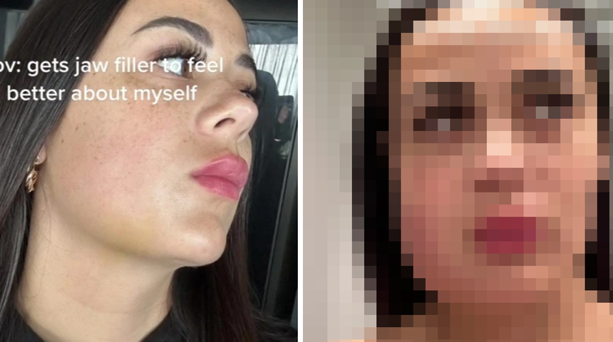 Güzellik uğruna başına gelenleri paylaştı! "Hayatımı mahvetti"