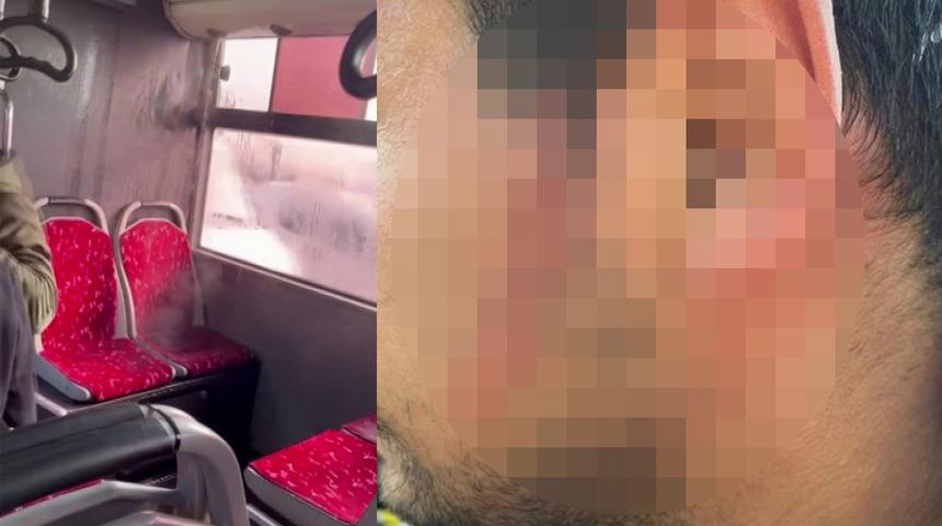 Yer: Ümraniye! Otobüsün içinde korku dolu anlar... Yolcunun yüzü yandı