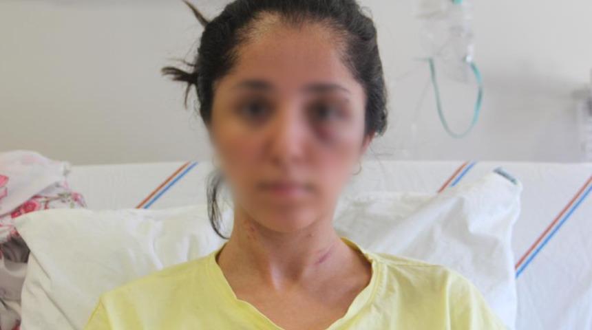 Kız arkadaşını darp eden doktor sevgili: Alkoll&uuml;yd&uuml;m hatırlamıyorum, bana 'adam değilsin' dedi