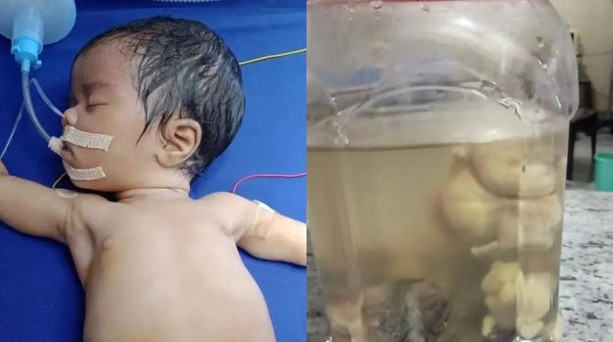 Yenidoğan bebeğin midesinden çıkanlar dudak uçuklattı: Tam 8 tane!