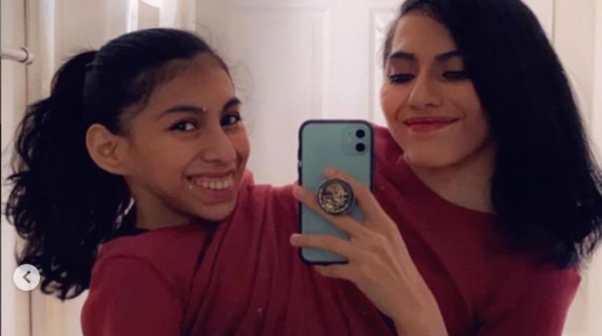 Yapışık ikiz kardeşler kız kardeşlerin cinsellik itirafı herkesi şaşırttı! “1 buçuk yıldır ilişkim var, sevgilim ve kız kardeşim...”