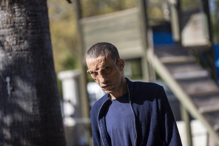 Türkiye onları yapılan yüz nakilleriyle tanımıştı! 10 yılda hayatları değişti, işte Uğur Acar ve Turan Çolak'ın son halleri... G4