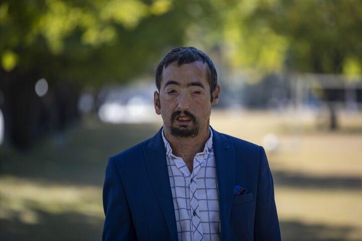 Türkiye onları yapılan yüz nakilleriyle tanımıştı! 10 yılda hayatları değişti, işte Uğur Acar ve Turan Çolak'ın son halleri... G5