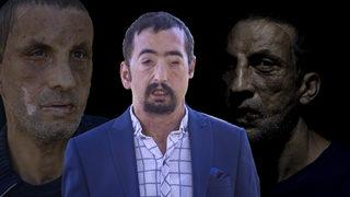 Türkiye onları yapılan yüz nakilleriyle tanımıştı! 10 yılda hayatları değişti, işte Uğur Acar ve Turan Çolak'ın son halleri...