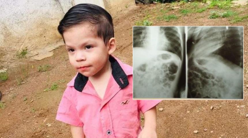 Yuttuğu pil içinde patladı! 2 yaşındaki ufaklık şimdi yaşam savaşı veriyor