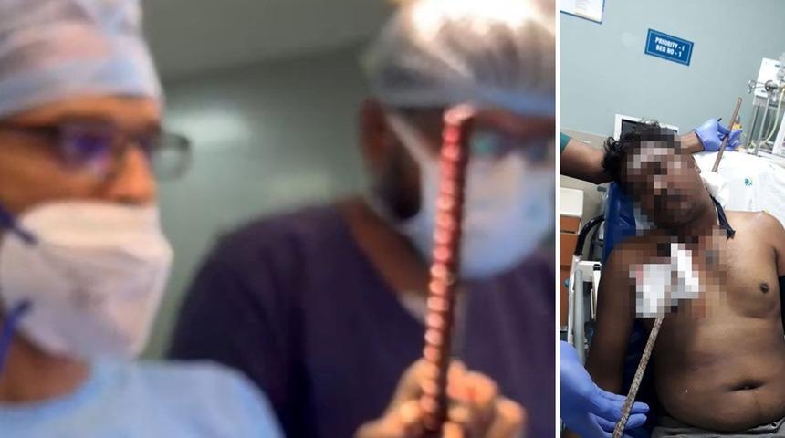 6 metre yüksekten düşüp 1,5 metrelik demire saplandı! Hayatta kalabilmesine doktorlar bile inanamadı