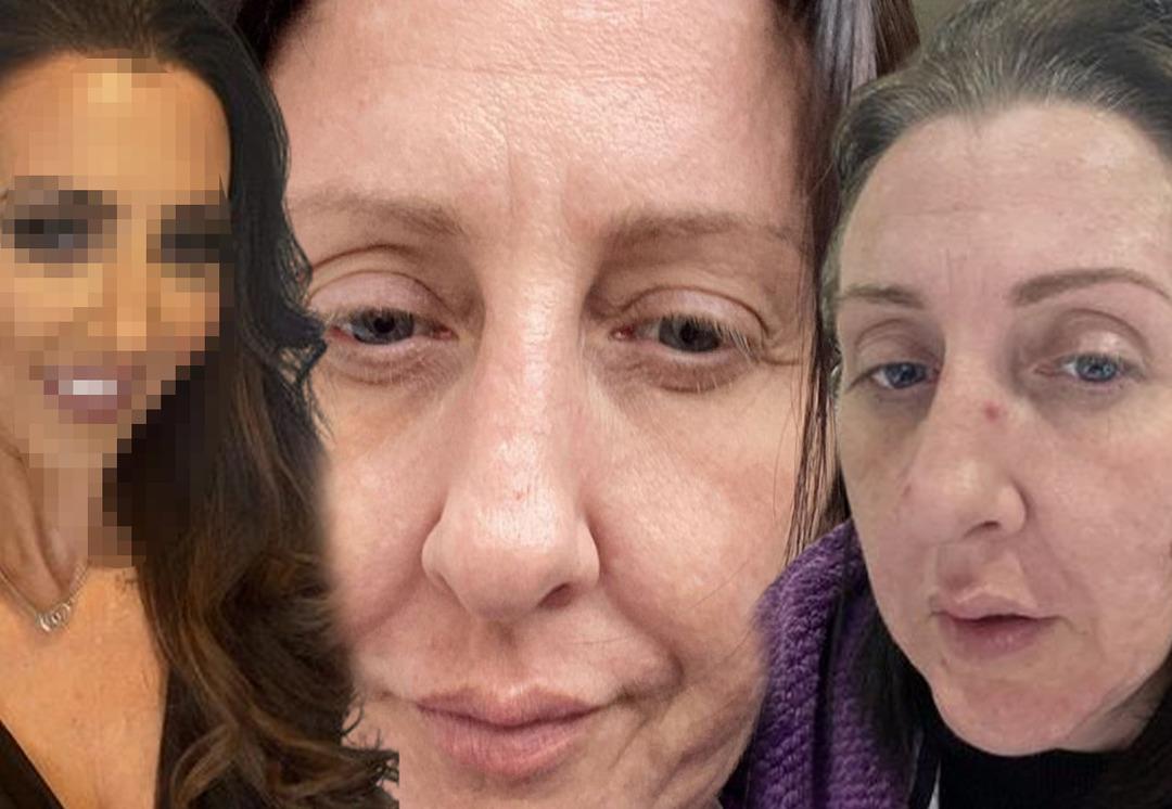 18 yıllık kocasının ihanetini &ouml;ğrendi! Değişimi ağızları a&ccedil;ık bıraktı... En yakınları bile tanıyamıyor