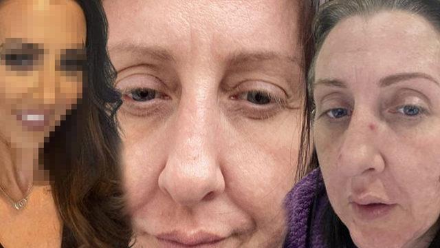 18 yıllık kocasının ihanetini öğrendi! Değişimi ağızları açık bıraktı... En yakınları bile tanıyamıyor