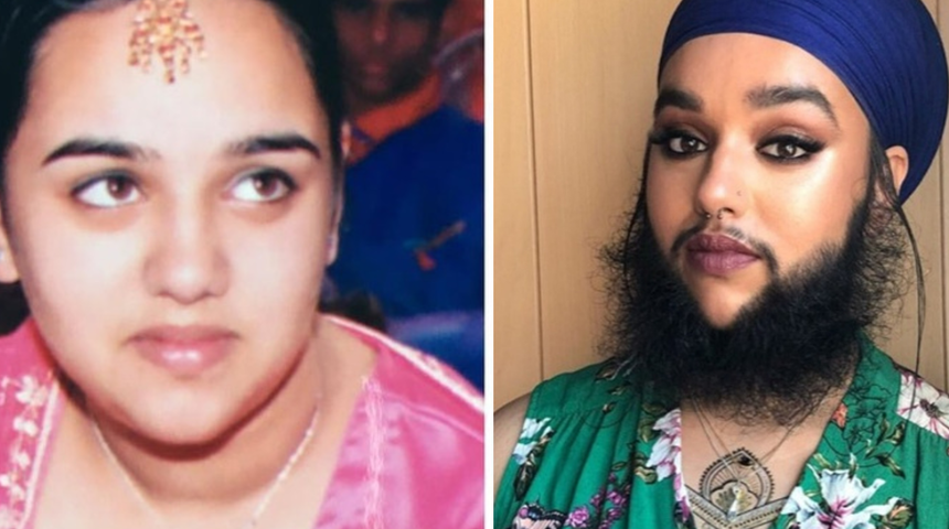 Hastalığıyla barışan kadın Guinness D&uuml;nya rekorlar kitabına girdi!