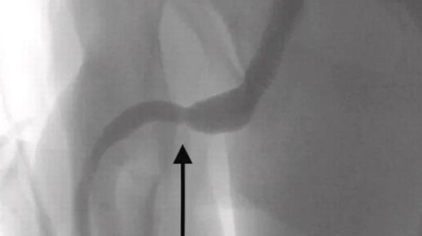 Cinsel deney isteği doktorları bile şaşkına çevirdi! Penisinden metrelerce uzunlukta USB kablosu çıktı