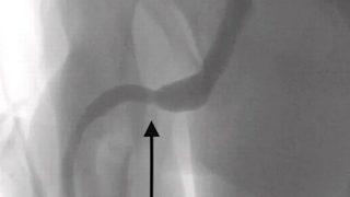 Cinsel deney isteği doktorları bile şaşkına çevirdi! Penisinden metrelerce uzunlukta USB kablosu çıktı