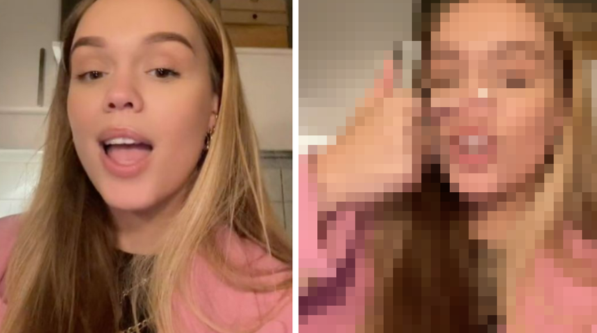 Burun kemiği olmadan doğan kadın burnunun şeklini TikTok'ta paylaştı! Görenler şaşırıyor