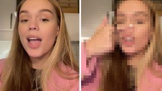 Burun kemiği olmadan doğan kadın burnunun şeklini TikTok'ta paylaştı! Görenler şaşırıyor