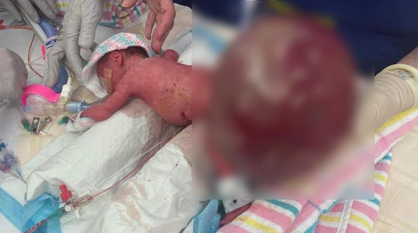 Kendisinden iki kat büyük! Doktorlar gözlerine inanamadı: Daha büyüğü görülmedi