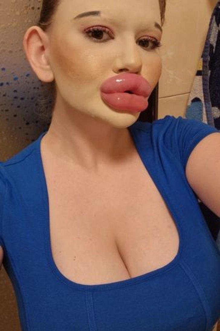 Dünyanın en büyük dudaklarına sahip! “Doktorlar ölebileceğimi söylüyor ama durmayacağım” G1