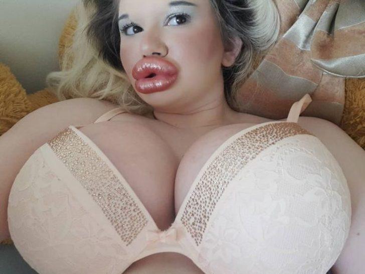 Dünyanın en büyük dudaklarına sahip! “Doktorlar ölebileceğimi söylüyor ama durmayacağım” G4