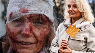 O fotoğraf savaşın sembolü olmuştu! Son haliyle ortaya çıktı O bir aktris ve fotoğraf 5 yıl öncesine ait iddialarına böyle yanıt verdi