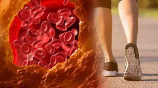 Sessiz Katilin ilk belirtisi yürürken ortaya çıkıyor! Tedavi edilmezse felç ve kalp krizi riski yüksek