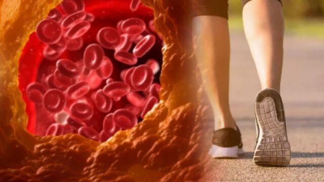 Sessiz Katilin ilk belirtisi yürürken ortaya çıkıyor! Tedavi edilmezse felç ve kalp krizi riski yüksek