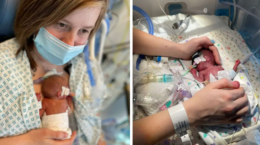 Doktorlar yaşamaz demişti! Bir somun ekmekten daha hafif doğan bebek yaşam mücadelesini kazandı