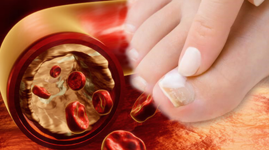 Görmezden gelmeyin: Tehlikeli hastalığın ilk belirtilerinden! Uzuv kaybına neden olabilir