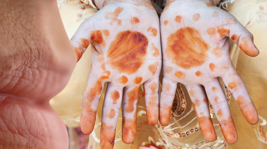 Ellerden sonra şimdi de dudaklarda! TikTok’ta dudaklara kına sürme akımı hızla yayılıyor... Uzmanlar uyardı