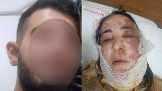 Çalan kapıyı açtı, hastanelik oldu! Firari üvey evlat her yerde aranıyor: Anneden dikkat çeken 'evlilik' iddiası