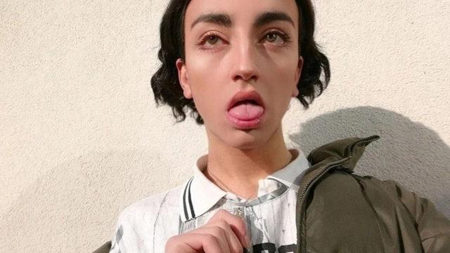 Kalça ve göğüs ameliyatı olmuştu... Mika Raun yatakta eteğini sıyırıp poz verdi! 