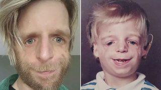 Doğumhanede ailesi yüzünü görünce terk etti! Hikayesi herkesi hüzünlendirdi... “Ailem yüzümü beğenmedikleri için beni hastanede terk etti”