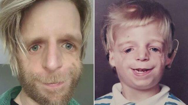 Doğumhanede ailesi yüzünü görünce terk etti! Hikayesi herkesi hüzünlendirdi... “Ailem yüzümü beğenmedikleri için beni hastanede terk etti”