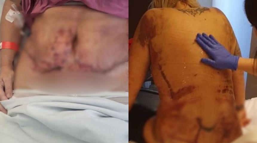 En korkunç doğum günü hediyesi: Çürükler içinde kaldı