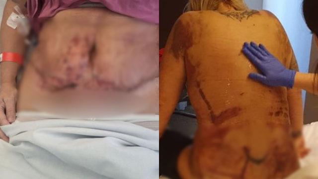 En korkunç doğum günü hediyesi: Çürükler içinde kaldı