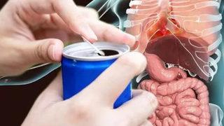 İki hafta boyunca içtiği içecek yüzünden hayatı karardı! Organ nakli oldu