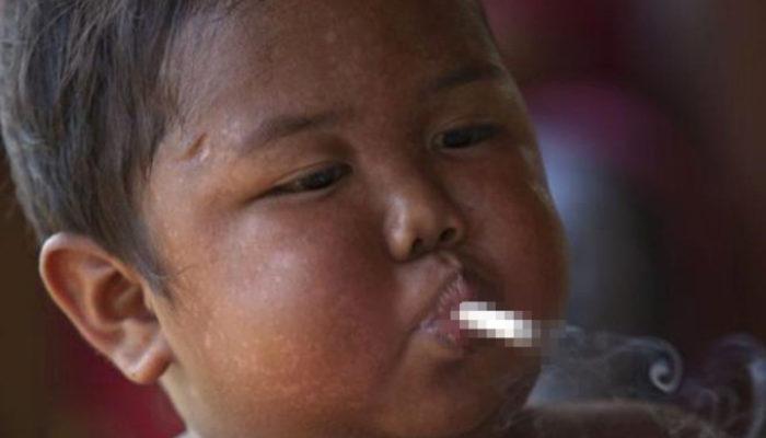 Daha iki yaşındayken günde 40 sigara içiyordu! Son hali şaşırttı