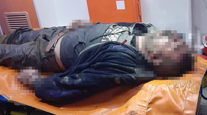 Sigara içerken uyuyakaldı! Dumanı gören içeri girdi: Her yeri yanmış