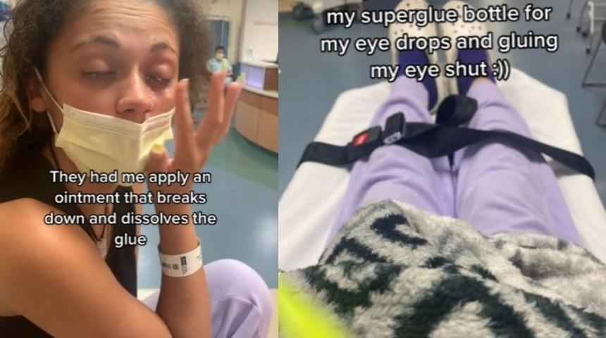 Göz damlası sandığı şey kuvvetli yapıştırıcı çıkınca soluğu hastanede aldı!