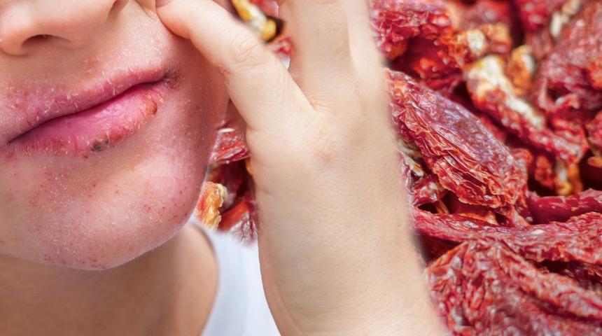Mide ülseri, sindirim sorunları, dudaklarda yara... En sevdiğiniz yiyecek aslında sizi bitiriyor