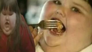 Sekiz yaşındayken 190 kiloydu! Günde 10 bin kalori yiyen “Dünyanın en şişman kızı” tamamen değişti... Görenler tanıyamıyor
