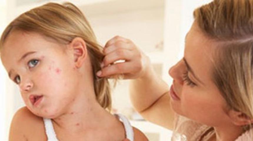 Bebeklerde Alerjenlere Dikkat!