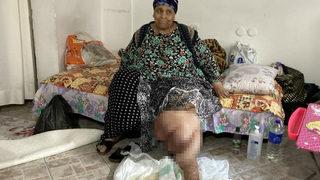 Her şey 5 ay önce başladı, bu hale geldi! Hastaneye başvurdu ama…