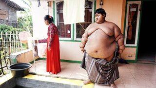 9 yaşındayken 190 kilo ağırlığındaydı! Dünyanın en şişman çocuğunun son hali görenler gözlerine inanamadı 