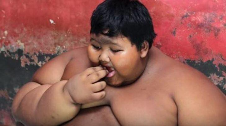 9 yaşındayken 190 kilo ağırlığındaydı! Dünyanın en şişman çocuğunun son hali görenler gözlerine inanamadı  G4