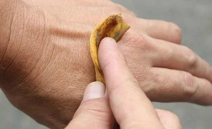 SEDEF HASTALIĞININ TEDAVİSİNDE YARDIMCI  