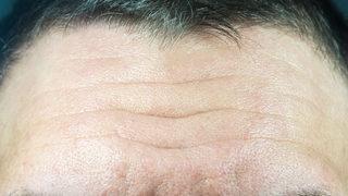 Bu görüntünün altında korkunç bir gerçek var! Sizde de varsa doktora koşun