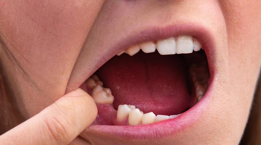Güçlendirmiyor çürütüyor: Dişlerinizin dökülmesi an meselesi! Hemen onu bırakın